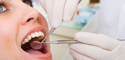 dental implants