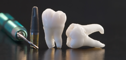 dental implants